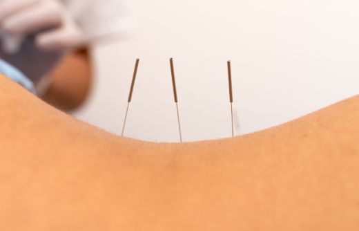 Myofasciale therapie